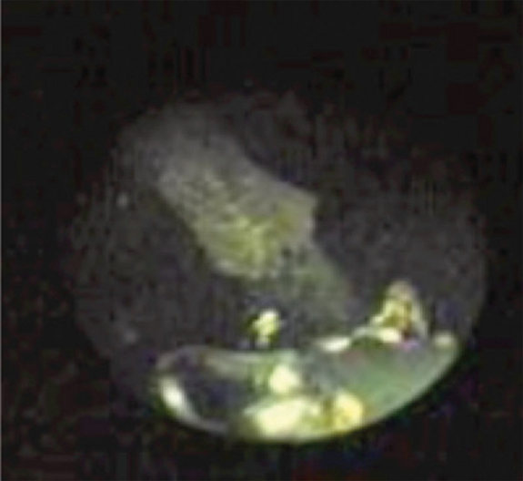 (RSNA RadioGraphics)