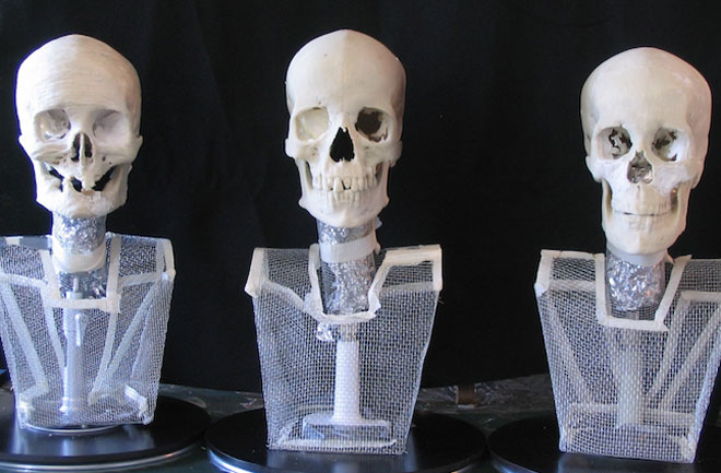 Ricreazione dei tre crani (McGill University)