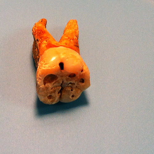 (McMaster University)