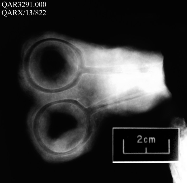 Le forbici (North Carolina Department of Cultural Resources)