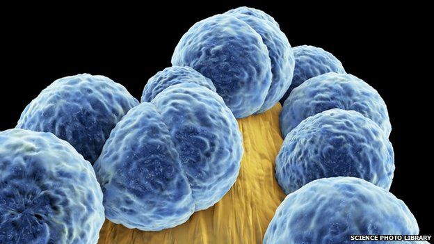 (Science Photo Library)