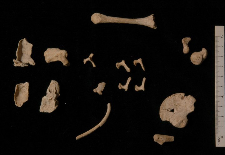 Le ossa del neonato (Antonis Bartsiokas)