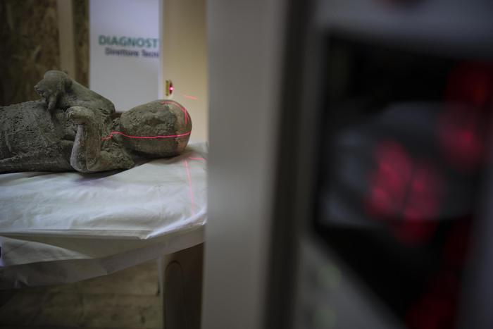 Alcune immagini della Tac (Tomograia assiale computerizzata) eseguita su una trentina di calchi delle vittime dell'eruzione del Vesuvio del 79 d.C. a Pompei, alla quale sta lavorando un'equipe di studiosi incaricati dalla Soprintendentza archeologica di Pompei, 29 Settembre 2015 (ANSA/ CESARE ABBATE)