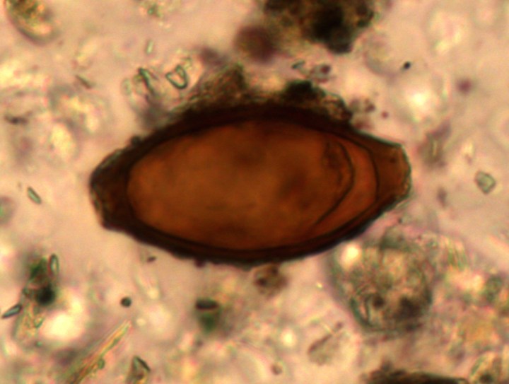 Un verme a frusta (Piers Mitchell)